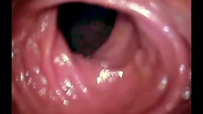 Anal Adventure Deep Into Her Colon Porn Video